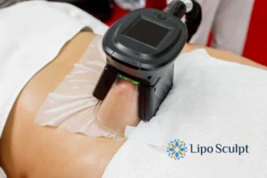Cryolipolysis Helping You Getting that Perfect Summer Body 3 Cryolipolysis Olney can give you the best summer body - contact us today!