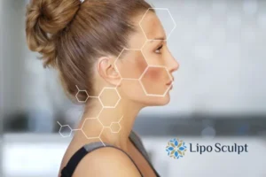 Are you looking at age spots Olney removal? Contact Lipo Sculpt today!