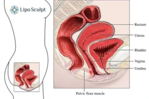 Treatment For A Leaky Bladder 2 How EM Chair treatment Olney can help Leaky bladder issues. Read more now!