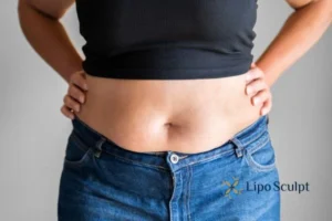 Bidding Farewell to Muffin Tops with Aqualyx Fat Injections 2 Do you wish you could reduce your muffin top Olney With Aqualy fat dissolving injections you can!